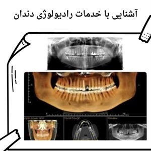 اهمیت رادیولوژی دندان در تشخیص دقیق بیماری های دهان و فک