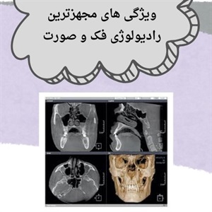 خدمات رادیولوژی فک و صورت سعادت آباد در درمان های دندانپزشکی